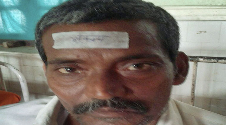 बिहारमध्ये जखमींच्या माथ्यावर लावले ‘भूकंप’ लिहलेले स्टिकर, चौकशीचे आदेश