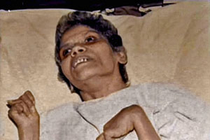 अरूणा शानबाग यांचा वाढदिवस याहीवर्षी साजरा होणार!
