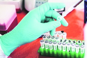 इबोलाच्या संसर्गावर प्रभावी औषध दृष्टिपथात इबोलाच्या संसर्गावर प्रभावी औषध दृष्टिपथात