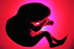 पीसीपीएनडीटी कक्ष स्थापन झाला; पण काम थंडावलेलेच!