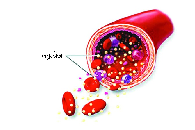 मागोवा मधुमेहाचा : साखर कमी झाली तर..