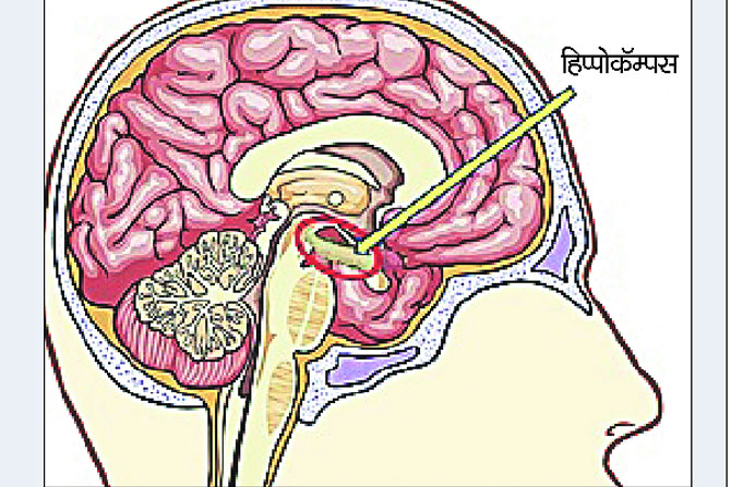 नैराश्यामुळे मेंदूतील हिप्पोकॅम्पसचे आकुंचन नैराश्यामुळे मेंदूतील हिप्पोकॅम्पसचे आकुंचन