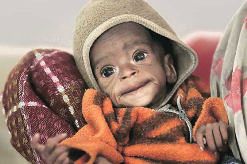 बालमृत्यू आणि कुपोषण यांची स्थिती गंभीरच असताना सरकारने त्यावरील उपाययोजनांसाठी होणाऱ्या खर्चास कात्री लावली.