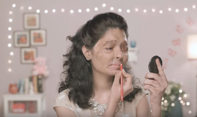 VIDEO: अॅसिड हल्ल्यातील पीडिता ब्युटी टीप्स देते तेव्हा.. VIDEO: अॅसिड हल्ल्यातील पीडिता ब्युटी टीप्स देते तेव्हा..