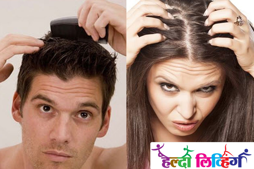 health tips in marathi, healthy living, hair, oil, hairoil, is hairoil necessary, hair health, hair growth, follicle growth, pollution, marathi news, marathi, Marathi news paper, Marathi news online, Marathi Samachar, Marathi latest news,news, entertainment marathi news, Bollywood news, Sports news in marathi, Health news, political news in marathi,breaking news,marathi batmya