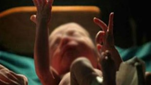 alive infant, alive infant, अर्भक