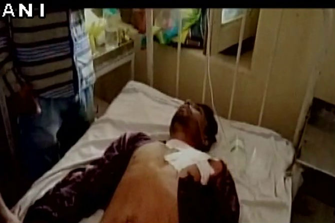 मध्य प्रदेशात आंदोलनादरम्यान केलेल्या गोळीबारात शेतकरी जखमी झाले आहेत. 