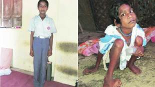 school boy , handicapped sister,