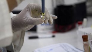 Malaria test