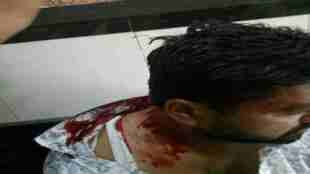 LIVE updates , MNS Raj Thackeray , फेरीवाल्यांच्या मारहाणीत जखमी, Sushant Malvade injured in Hawkers attack , Malad , Mumbai, Sanjay Nirupam , Loksatta, Loksatta news, Marathi, Marathi news