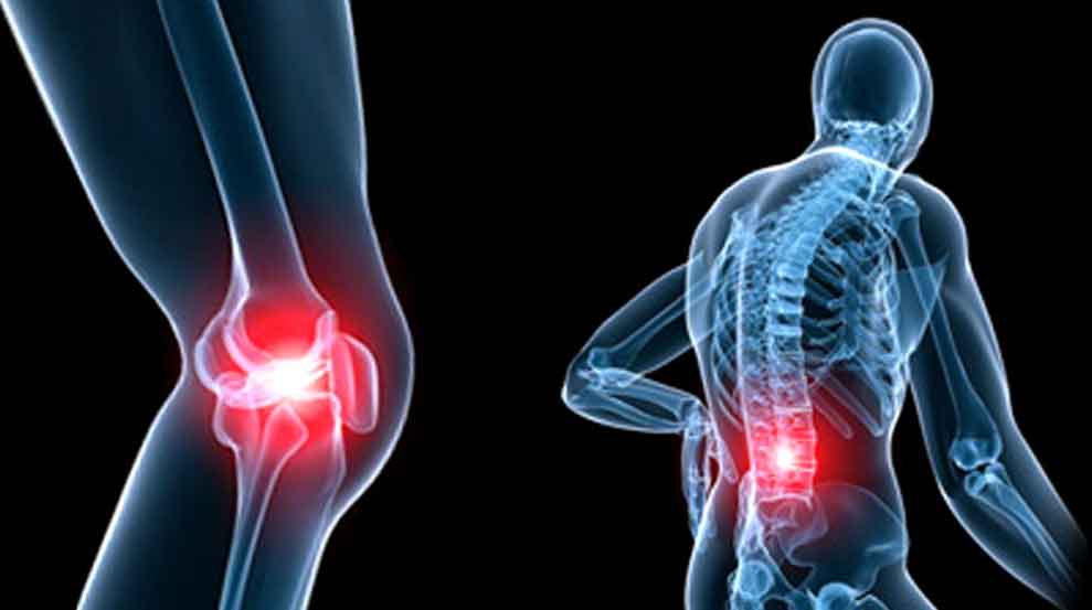 arthritis