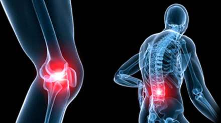 arthritis