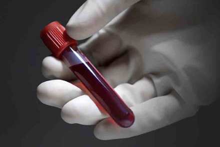 Blood test