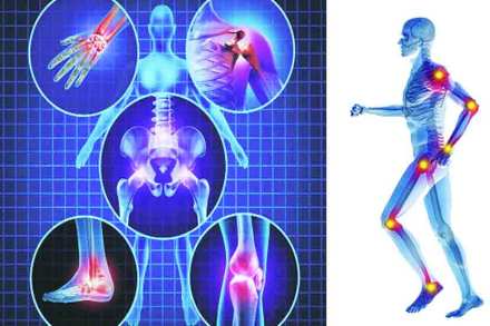 संग्रहित प्रतिनिधिक छायाचित्र