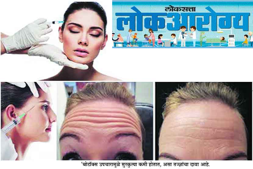 बोटॉक्सची मोहिनी बोटॉक्सची मोहिनी