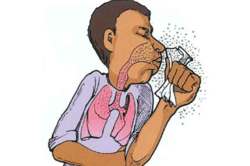 क्षयजंतू नाशाचा ‘रामबाण’ सापडला