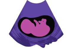 स्त्रीत्वाचा हक्कही नाकारणार?