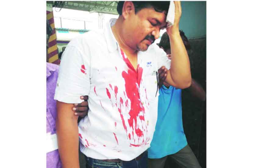 जखमी झालेले गार्ड राजेश यादव