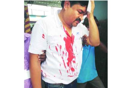 जखमी झालेले गार्ड राजेश यादव