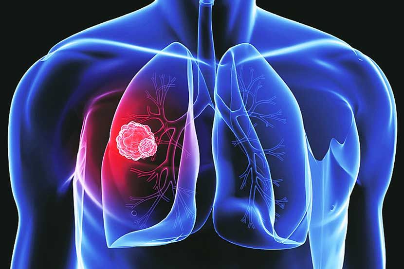 (सांकेतिक छायाचित्र) (सांकेतिक छायाचित्र)