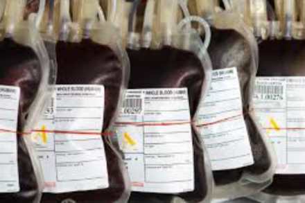 संग्रहित छायाचित्र संग्रहित छायाचित्र