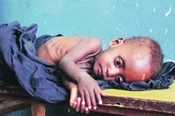 ..तरीही कुपोषणाच्या समस्येत फरक नाही