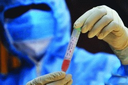 विषाणूच्या अधिक जवळ जाणारी माणसे..!