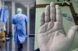 PPE कीट काढल्यानंतर… डॉक्टरने शेअर केलेला हाताचा फोटो झाला व्हायरल