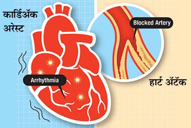 समजून घ्या : हार्ट अ‍टॅक आणि कार्डिअ‍ॅक अरेस्टमधला नक्की फरक काय?
