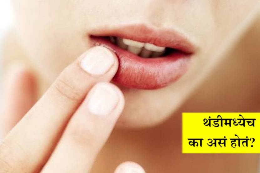 जाणून घ्या : हिवाळ्यात त्वचा कोरडी का पडते?