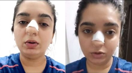 ऑर्डर रद्द केली म्हणून झोमॅटो डिलिव्हरी बॉयने महिलेचं नाकच फोडलं; रक्तबंबाळ अवस्थेतील व्हिडीओ केला पोस्ट