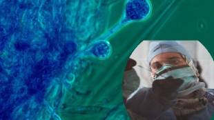 mucormycosis in maharashtra