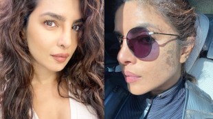 priyanka-chopra-injuried