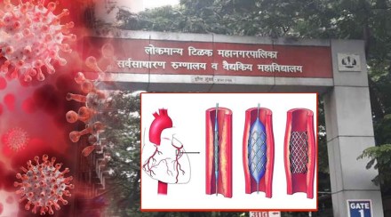 heart surgeries in sion hospital heart surgeries in sion hospital