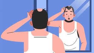 hair-fall-in-men