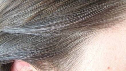 white-hair-problem-670