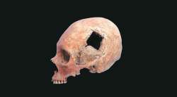 चेतासंस्थेची शल्यकथा : इतिहासाच्या झरोक्यातून..