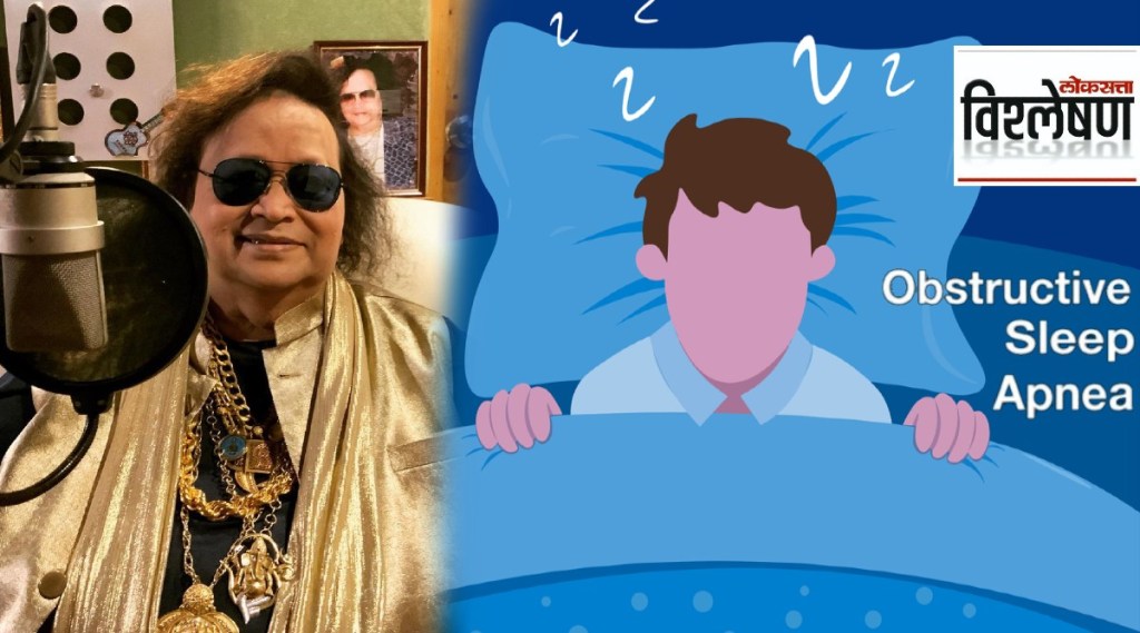 Bappi Lahiri Died Due To Obstructed Sleep Apnea
