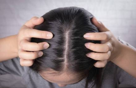 scalp-acne