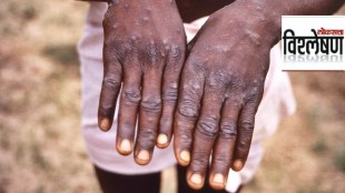 What is Monkeypox