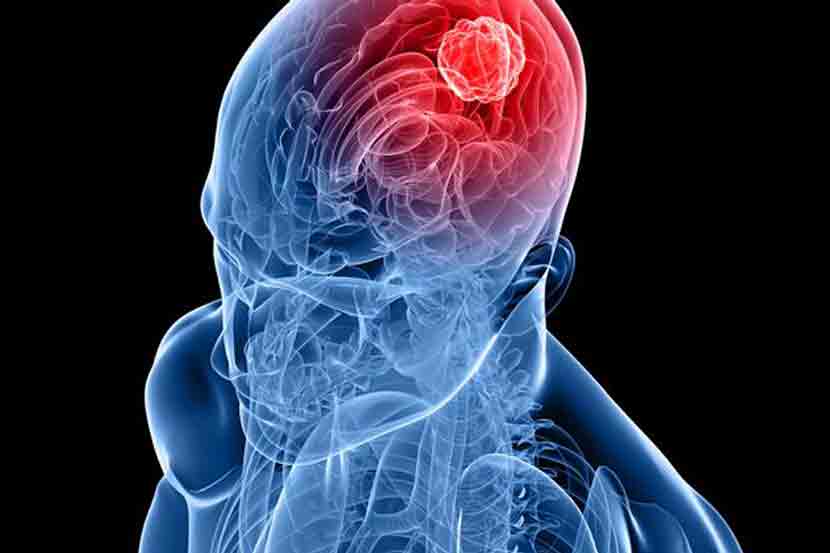 World Brain Tumour Day 2022