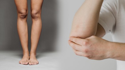 Annoyed by dark knees and corners?