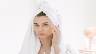 dark circles