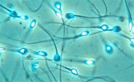 Sperm count decreases in men due to these 5 problems know how to improve it