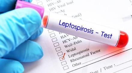 leptospirosis