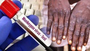 Know the do's and don'ts amid rising cases of monkeypox in India