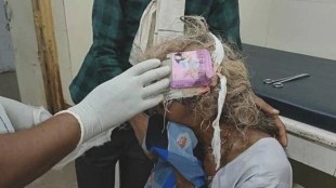 Condom packet applied to woman wound instead of cotton