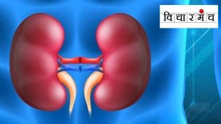 Kidney racket and law Vicharmancha