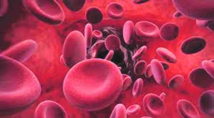 sickle cell