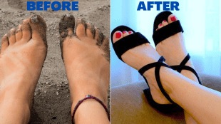 Pedicure at Home Got sandal marks on your feet anti tanning home remedies